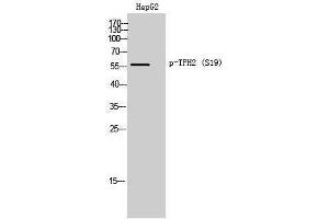 Western Blotting (WB) image for anti-Tryptophan Hydroxylase 2 (TPH2) (pSer19) antibody (ABIN3182390) (Tryptophan Hydroxylase 2 antibody  (pSer19))