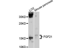 Western blot analysis of extracts of various cell lines, using FGF21 antibody. (FGF21 antibody)