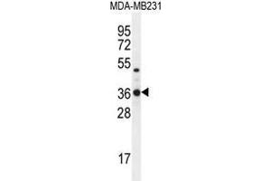 TPSD1 Antibody (C-term) western blot analysis in MDA-MB231 cell line lysates (35 µg/lane). (TPSD1 antibody  (C-Term))