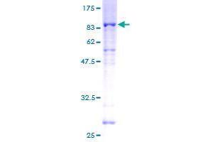 SDS-PAGE (SDS) image for serine/threonine Kinase 38 Like (STK38L) protein (GST tag) (ABIN1321702) (STK38L Protein (GST tag))