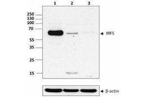 Western Blotting (WB) image for anti-Interferon Regulatory Factor 5 (IRF5) antibody (ABIN2666392) (IRF5 antibody)