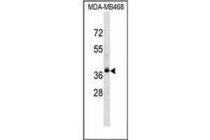 Western blot analysis of P2RY9 / LPAR4 Antibody (Center) in MDA-MB468 cell line lysates (35ug/lane).