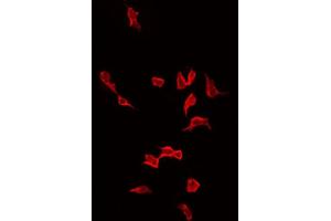 ABIN6268879 staining LOVO by IF/ICC. (Actin antibody  (N-Term))