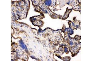 IHC analysis of TFRC using anti-TFRC antibody (ABIN3043538).