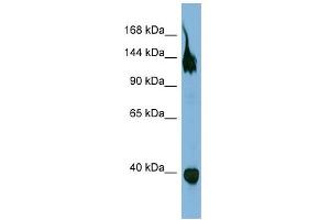 WB Suggested Anti-SEMA6A Antibody Titration:  0. (SEMA6A antibody  (Middle Region))