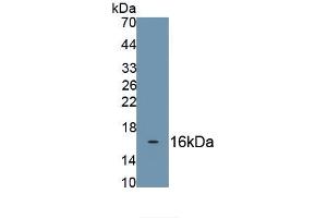 Detection of Recombinant NTRK1, Human using Monoclonal Antibody to Neurotrophic Tyrosine Kinase Receptor Type 1 (NTRK1)