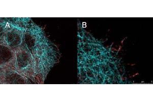 Immunofluorescence (IF) image for anti-V-Akt Murine Thymoma Viral Oncogene Homolog 1 (AKT1) (Ser473) antibody (ABIN400784) (AKT1 antibody  (Ser473))
