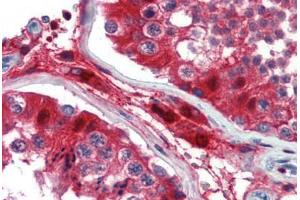 Human Testis (formalin-fixed, paraffin-embedded) stained with GATA3 antibody ABIN462169 followed by biotinylated goat anti-rabbit IgG secondary antibody ABIN481713, alkaline phosphatase-streptavidin and chromogen. (GATA3 antibody  (AA 36-85))