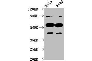 Western Blot Positive WB detected in: Hela whole cell lysate, K562 whole cell lysate All lanes: CYP7A1 antibody at 4. (CYP7A1 antibody  (AA 303-423))