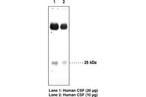 Image no. 1 for anti-Prostaglandin D2 Synthase (PTGDS) antibody (ABIN2451689) (PTGDS antibody)