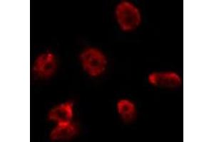 ABIN6275688 staining Hela by IF/ICC. (ZC3H8 antibody  (Internal Region))