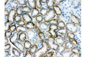 Anti- SLC22A2 Picoband antibody, IHC(P) IHC(P): Mouse Kidney Tissue (SLC22A2 antibody  (Middle Region))