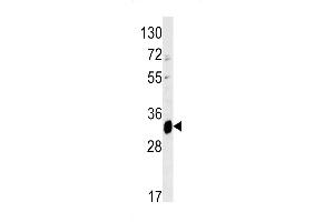 Western blot analysis of ELOVL6 antibody (N-term) (ABIN390425 and ABIN2840812) in mouse liver tissue lysates (35 μg/lane). (ELOVL6 antibody  (N-Term))