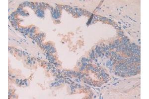 Immunohistochemistry (IHC) image for anti-Chordin (CHRD) (AA 700-918) antibody (ABIN7442051)