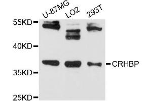 Western blot analysis of extracts of various cell lines, using CRHBP antibody (ABIN6291541) at 1:3000 dilution.