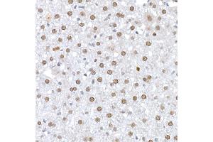 Immunohistochemistry (IHC) image for anti-Interleukin 6 Signal Transducer (Gp130, Oncostatin M Receptor) (IL6ST) (AA 678-857) antibody (ABIN7268004)