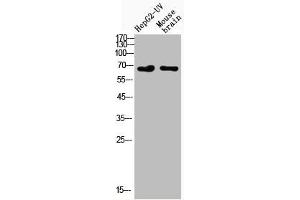 Western Blot analysis of HepG2-UVmouse brain cells using Acetyl-NFκB-p65 (K122) Polyclonal Antibody (NF-kB p65 antibody  (acLys122))