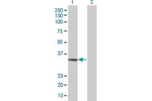 Western Blot analysis of ADAMTS4 expression in transfected 293T cell line by ADAMTS4 MaxPab polyclonal antibody. (ADAMTS4 antibody  (AA 1-339))