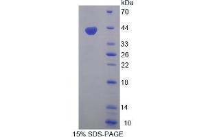 Image no. 1 for Wingless-Type MMTV Integration Site Family, Member 3A (WNT3A) (AA 1-284) protein (His tag) (ABIN6238288) (WNT3A Protein (AA 1-284) (His tag))