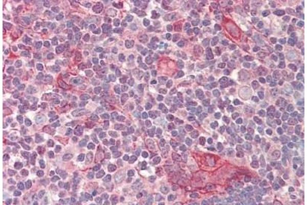 NUSAP1 antibody  (AA 360-409)