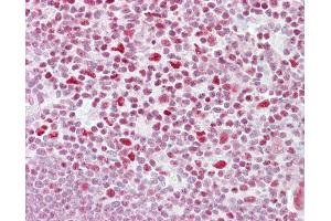 Anti-NFATC3 antibody IHC of human thymus. (NFATC3 antibody  (AA 324-373))