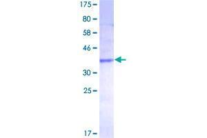Chemokine (C-C Motif) Ligand 27 (CCL27) (AA 1-112) protein (GST tag)