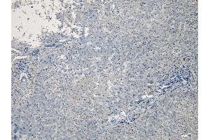 (ABIN185371) Negative Control showing staining of paraffin embedded Human Liver, with no primary antibody. (PCSK9 antibody  (C-Term))