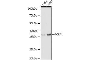 Western blot analysis of extracts of various cell lines, using TCE antibody (0541) at 1:1000 dilution.