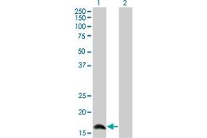 Western Blot analysis of IFNA2 expression in transfected 293T cell line by IFNA2 monoclonal antibody (M36), clone 2C10. (IFNA2 antibody  (AA 24-188))