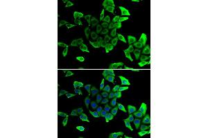 Immunofluorescence analysis of U2OS cells using SGCD antibody. (SGCD antibody)