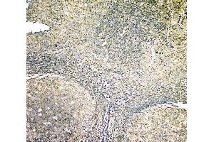 IHC analysis of ARA9/AIP using anti-ARA9/AIP antibody (ABIN6719423). (AIP antibody  (AA 91-330))