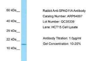 Western Blotting (WB) image for anti-Sperm Associated Antigen 11A (SPAG11A) (N-Term) antibody (ABIN2774411)