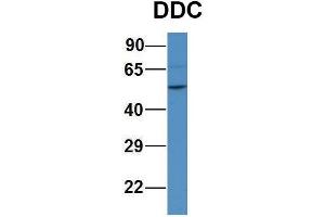 WB Suggested Anti-DDC Antibody Titration:  1ug/ml  Positive Control:  Human 293T cell lysate (DDC antibody  (N-Term))