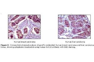 Image no. 1 for anti-B-Cell CLL/lymphoma 10 (BCL10) antibody (ABIN207592) (BCL10 antibody)