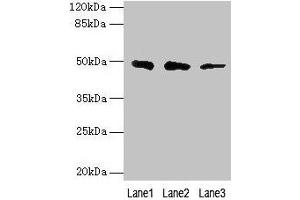 Western blot All lanes: ZBTB6 antibody at 8 μg/mL Lane 1: Hela whole cell lysate Lane 2: HepG2 whole cell lysate Lane 3: 293T whole cell lysate Secondary Goat polyclonal to rabbit IgG at 1/10000 dilution Predicted band size: 49 kDa Observed band size: 49 kDa (ZBTB6 antibody  (AA 115-424))