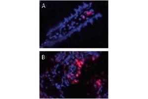 Immunofluorescence (IF) image for anti-S100 Calcium Binding Protein A8/A9 (S100A8/A9) antibody (ABIN953504) (S100A8/A9 Complex (Calprotectin) antibody)