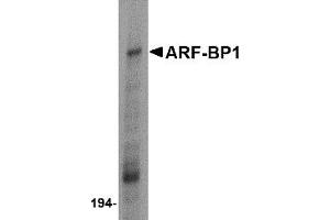 Western Blotting (WB) image for anti-HECT, UBA and WWE Domain Containing 1, E3 Ubiquitin Protein Ligase (HUWE1) (C-Term) antibody (ABIN1030253) (HUWE1 antibody  (C-Term))