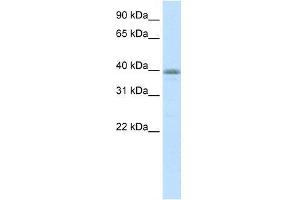 Transfected 293T; WB Suggested Anti-NEUROD6 Antibody Titration: 0. (NEUROD6 antibody  (N-Term))