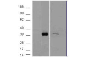 Image no. 2 for anti-Aldo-Keto Reductase Family 1, Member B10 (Aldose Reductase) (AKR1B10) (C-Term) antibody (ABIN374920) (AKR1B10 antibody  (C-Term))