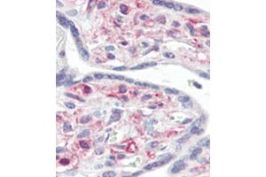 Immunohistochemical analysis of formalin-fixed and paraffin-embedded human Placenta tissue reacted with IRAK Antibody (C-term), which was peroxidase-conjugated to the secondary antibody, followed by AEC staining. (IRAK1 antibody)