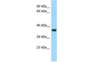 Host: Rabbit Target Name: C15orf52 Sample Type: Fetal Heart lysates Antibody Dilution: 1. (C15ORF52 antibody  (C-Term))