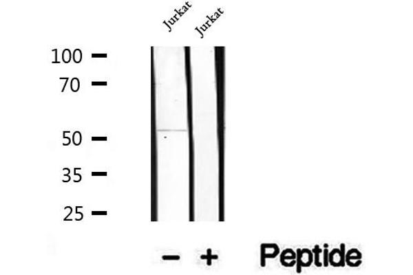 GSDMD antibody