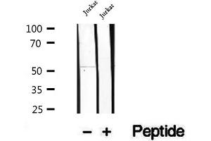 Western blot analysis of extracts of Jurkat cells, using GSDMD antibody. (GSDMD antibody)