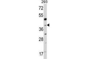 Western blot analysis of NAGK (arrow) in 293 cell line lysates (35ug/lane) using NAGK  Antibody (C-term). (NAGK antibody  (C-Term))