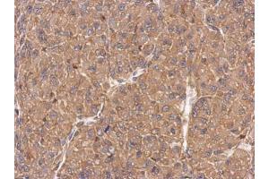 IHC-P Image Immunohistochemical analysis of paraffin-embedded U87 xenograft, using FMNL1, antibody at 1:500 dilution. (Formin-Like 1 antibody)