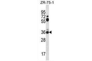 Western blot analysis in ZR-75-1 cell line lysates (35µg/lane) using Syntaxin 2 / STX2 Antibody (Center) Cat. (STX2 antibody  (Middle Region))