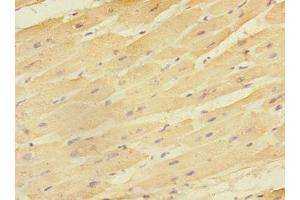 Immunohistochemistry of paraffin-embedded human heart tissue using ABIN7151514 at dilution of 1:100 (EAF2 antibody  (AA 1-170))