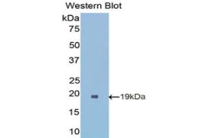 Western Blotting (WB) image for anti-Superoxide Dismutase 1, Soluble (SOD1) (AA 2-154) antibody (ABIN1078539) (SOD1 antibody  (AA 2-154))