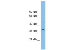 SECTM1 antibody used at 1 ug/ml to detect target protein.