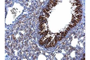 IHC-P Image MTMR9 antibody [C3], C-term detects MTMR9 protein at cytoplasm on mouse lung by immunohistochemical analysis. (MTMR9 antibody  (C-Term))